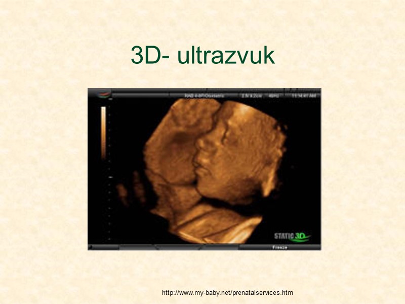 3D- ultrazvuk http://www.my-baby.net/prenatalservices.htm